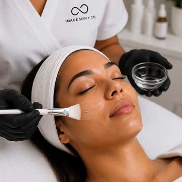 Chemical peel treatment
