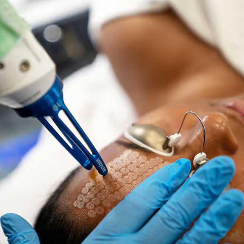 Advanced treatment for pigmentation concerns